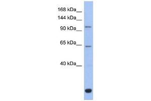 WB Suggested Anti-BACH2 Antibody Titration: 0. (BACH2 antibody  (Middle Region))