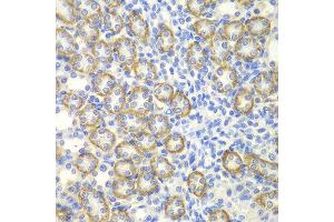 Immunohistochemistry of paraffin-embedded rat kidney using SYT1 antibody at dilution of 1:200 (400x lens). (SYT1 antibody)