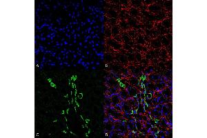 Immunohistochemistry analysis using Rabbit Anti-UT-A1 Polyclonal Antibody (ABIN863205). (Solute Carrier Family 14 (Urea Transporter, Kidney) Member 2 (SLC14A2) (AA 911-929) antibody)