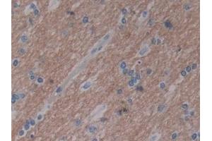 Detection of 15-LO-2 in Human Cerebrum Tissue using Polyclonal Antibody to 15-Lipoxygenase-2 (15-LO-2) (ALOX15B antibody  (AA 253-490))