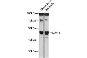 Western blot analysis of extracts of various cell lines, using CDK15 antibody (ABIN6131335, ABIN6138309, ABIN6138310 and ABIN6217056) at 1:3000 dilution. (Cyclin-Dependent Kinase 15 (ALS2CR7) (AA 271-400) antibody)