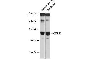 Western blot analysis of extracts of various cell lines, using CDK15 antibody (ABIN6131335, ABIN6138309, ABIN6138310 and ABIN6217056) at 1:3000 dilution. (Cyclin-Dependent Kinase 15 (ALS2CR7) (AA 271-400) antibody)