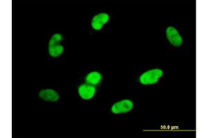 Immunofluorescence of monoclonal antibody to SOX9 on HepG2 cell. (SOX9 antibody  (AA 400-509))