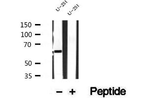 Western blot analysis of extracts of U-251 cells, using Sur-8 antibody. (SHoc2/Sur8 antibody  (C-Term))