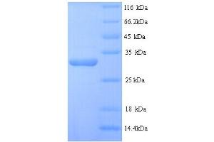 SDS-PAGE (SDS) image for Desmoplakin (DSP) (AA 78-300), (partial) protein (His tag) (ABIN5713408) (Desmoplakin Protein (DSP) (AA 78-300, partial) (His tag))