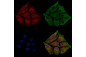 ABIN6261746 and ABIN6268882 staining HepG2 cells(30 min of 4uM Forskolin treatment) by IF/ICC. (Fibronectin antibody  (C-Term))