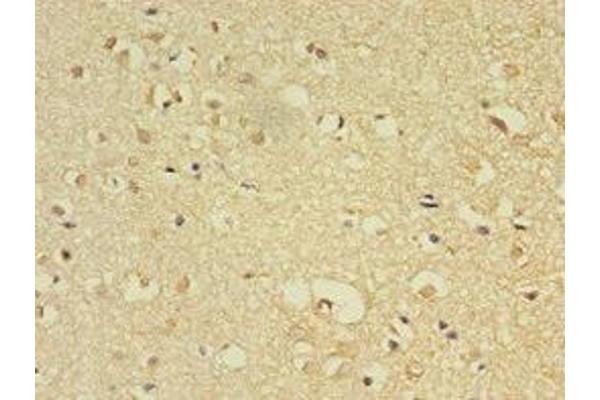FLRT1 antibody  (AA 21-289)