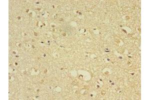 Immunohistochemistry of paraffin-embedded human brain tissue using ABIN7158118 at dilution of 1:100