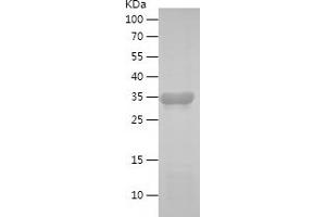 Western Blotting (WB) image for Replication Protein A1, 70kDa (RPA1) (AA 16-162) protein (His-IF2DI Tag) (ABIN7282797) (RPA1 Protein (AA 16-162) (His-IF2DI Tag))