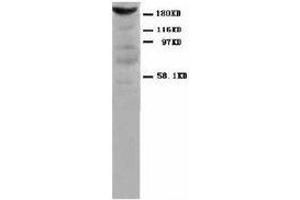 Image no. 1 for anti-Myosin, Light Chain 1, Alkali, Skeletal, Fast (MYL1) antibody (ABIN1502212) (MYL1 antibody)