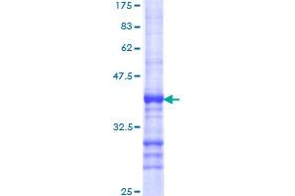 FZD6 Protein (AA 71-181) (GST tag)