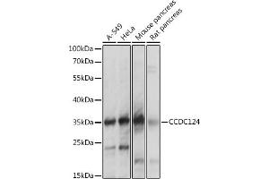 Western blot analysis of extracts of various cell lines, using CCDC124 antibody  at 1:1000 dilution.