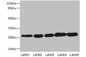 Western blot All lanes: GSTK1 antibody at 0. (GSTK1 antibody  (AA 1-226))