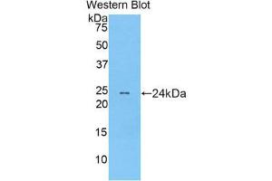 Western Blotting (WB) image for anti-Myosin, Light Chain 12B, Regulatory (MYL12B) (AA 5-172) antibody (ABIN1859938) (MYL12B antibody  (AA 5-172))