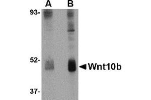 Western Blotting (WB) image for anti-Wingless-Type MMTV Integration Site Family, Member 10B (WNT10B) (Middle Region) antibody (ABIN1031166) (WNT10B antibody  (Middle Region))