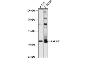 Western blot analysis of extracts of various cell lines, using PIP1 antibody (ABIN7269160) at 1:1000 dilution. (PAK1IP1 antibody  (AA 1-392))