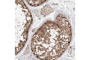 Immunohistochemical staining of human testis with MAGEB4 polyclonal antibody  shows moderate cytoplasmic and nuclear positivity in cells in seminiferus ducts at 1:200-1:500 dilution.