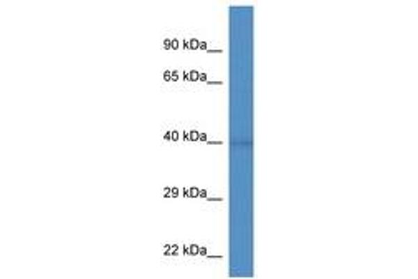 WDR92 Antikörper  (AA 155-204)