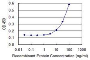 Detection limit for recombinant GST tagged CTRB1 is 3 ng/ml as a capture antibody. (CTRB1 antibody  (AA 101-200))