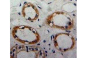 #VALUE! (CD59 antibody  (AA 23-105))