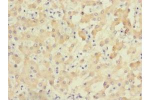 Immunohistochemistry of paraffin-embedded human liver tissue using ABIN7176327 at dilution of 1:100