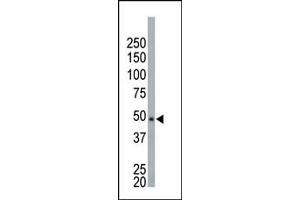 The anti-NEK2 Pab (ABIN392649 and ABIN2837992) is used in Western blot to detect NEK2 in HeLa cell lysate. (NEK2 antibody  (AA 350-382))