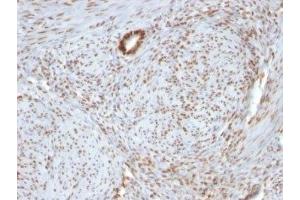 Immunohistochemistry (IHC) image for anti-Nucleolin (NCL) antibody (ABIN3025715)