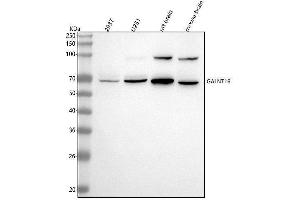 Western blot analysis of GALNT16 using anti-GALNT16 antibody (ABIN7599477).