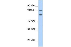 WB Suggested Anti-RBM35B Antibody Titration:  2.