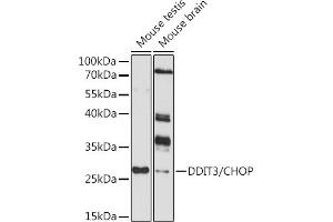 Western blot analysis of extracts of various cell lines, using DDIT3/CHOP antibody (ABIN6134637, ABIN6139459, ABIN6139462 and ABIN6214005) at 1:1000 dilution. (DDIT3 antibody  (AA 1-100))