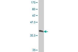 Western Blot detection against Immunogen (38. (NUP98 antibody  (AA 1-110))