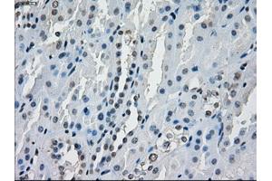Immunohistochemical staining of paraffin-embedded endometrium tissue using anti-AURKCmouse monoclonal antibody. (Aurora Kinase C antibody)