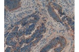 Used in DAB staining on fromalin fixed paraffin- embedded liver tissue (Biglycan antibody  (AA 48-158))