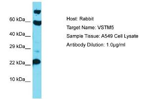 Host: Rabbit Target Name: VSTM5 Sample Type: A549 Whole Cell lysates Antibody Dilution: 1. (VSTM5 antibody  (C-Term))