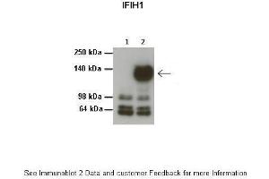 Lanes:   1: 20ug HEK293T no transfection, 2: 20ug HEK293T 3Flag-MDA5/IFIH1  Primary Antibody Dilution:   1:1000  Secondary Antibody:   Anti-rabbit HRP  Secondary Antibody Dilution:   1:1000  Gene Name:   IFIH1  Submitted by:   Dr. (IFIH1 antibody  (Middle Region))