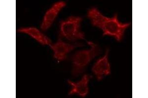 ABIN6274943 staining A549 cells by IF/ICC. (PDE4C antibody  (Internal Region))