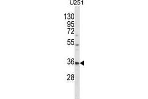 VPS37B Antibody (Center) western blot analysis in U251 cell line lysates (35 µg/lane). (VPS37B antibody  (Middle Region))