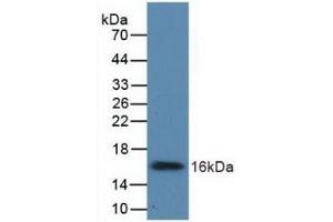 Detection of Recombinant UGCG, Human using Polyclonal Antibody to UDP Glucose Ceramide Glucosyltransferase (UGCG) (UGCG antibody  (AA 39-171))