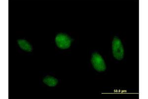 Immunofluorescence of purified MaxPab antibody to MAPK8 on HeLa cell. (JNK antibody  (AA 1-427))