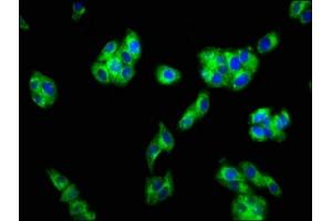 Immunofluorescence staining of HepG2 cells with ABIN7153159 at 1:133, counter-stained with DAPI. (FFAR1 antibody  (AA 143-178))