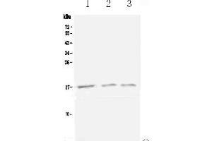 Western blot analysis of Lymphotactin using anti-Lymphotactin antibody .