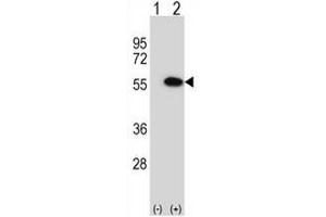 Western blot analysis of MINA (arrow) using rabbit polyclonal MINA Antibody (N-term) . (MINA antibody  (N-Term))