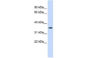 GPR6 antibody used at 1 ug/ml to detect target protein.