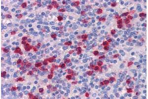 Human Spleen: Formalin-Fixed, Paraffin-Embedded (FFPE) (EFCAB4A antibody  (Internal Region))