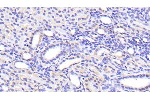 Detection of SLC39A7 in Human Kidney Tissue using Polyclonal Antibody to Solute Carrier Family 39, Member 7 (SLC39A7) (SLC39A7 antibody  (AA 171-469))