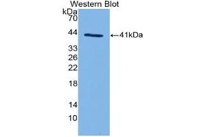 Western blot analysis of the recombinant protein. (C3a antibody  (AA 670-742))