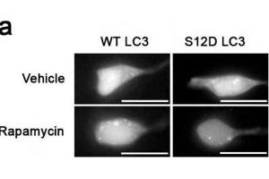 Western Blotting (WB) image for anti-Microtubule-Associated Protein 1 Light Chain 3 gamma (MAP1LC3C) (pSer12) antibody (ABIN2970987) (LC3C antibody  (pSer12))