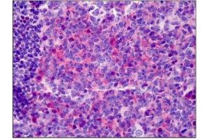 Human Tonsil: Formalin-Fixed, Paraffin-Embedded (FFPE) (Neuregulin 1 antibody  (Isoform 10, N-Term))