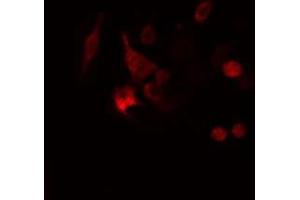 ABIN6277987 staining  Hela cells by IF/ICC. (Calretinin antibody  (Internal Region))