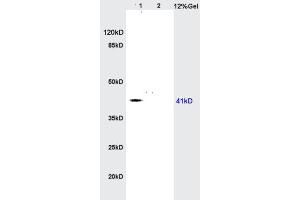 Lane 1: rat brain lysates Lane 2: rat heart lysates probed with Anti AGPAT4 Polyclonal Antibody, Unconjugated  at 1:200 in 4˚C. (AGPAT4 antibody  (AA 231-330))